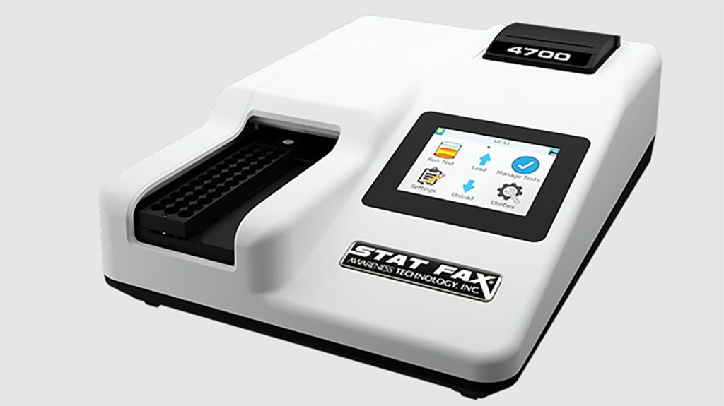 Image: The Stat Fax 4700 ELISA strip reader has received an upgraded screen, faster processor, and a new user interface (Photo courtesy of Awareness)