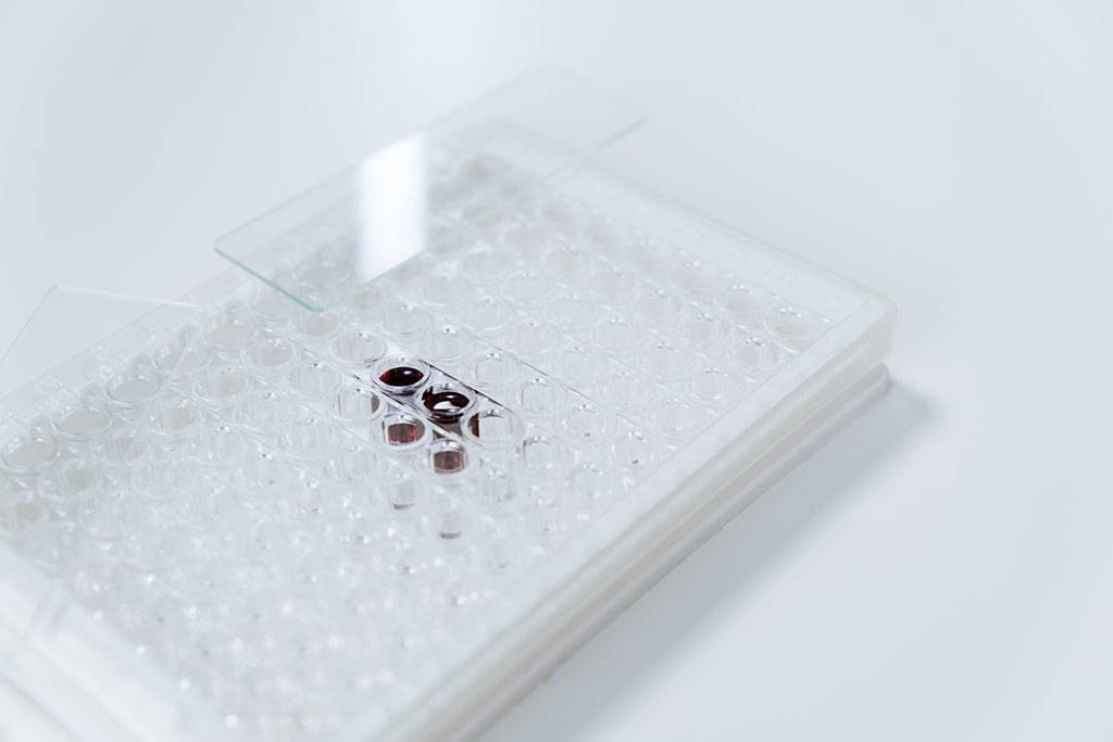 Image: Sampling a single stool using multiple PCR panels can identify more pathogens rapidly (Photo courtesy of Pexels)
