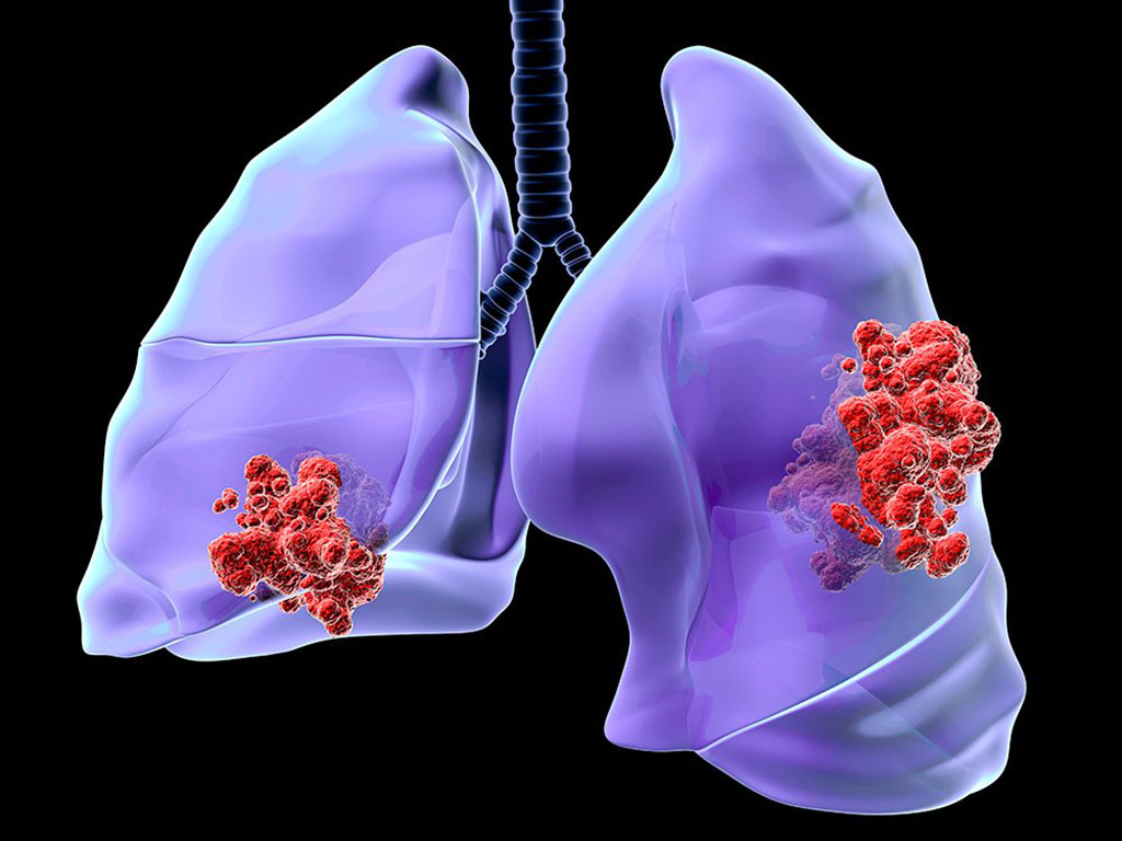 Image: Mercy Halo is a pioneering test being developed for early cancer detection (Photo courtesy of Mercy BioAnalytics)