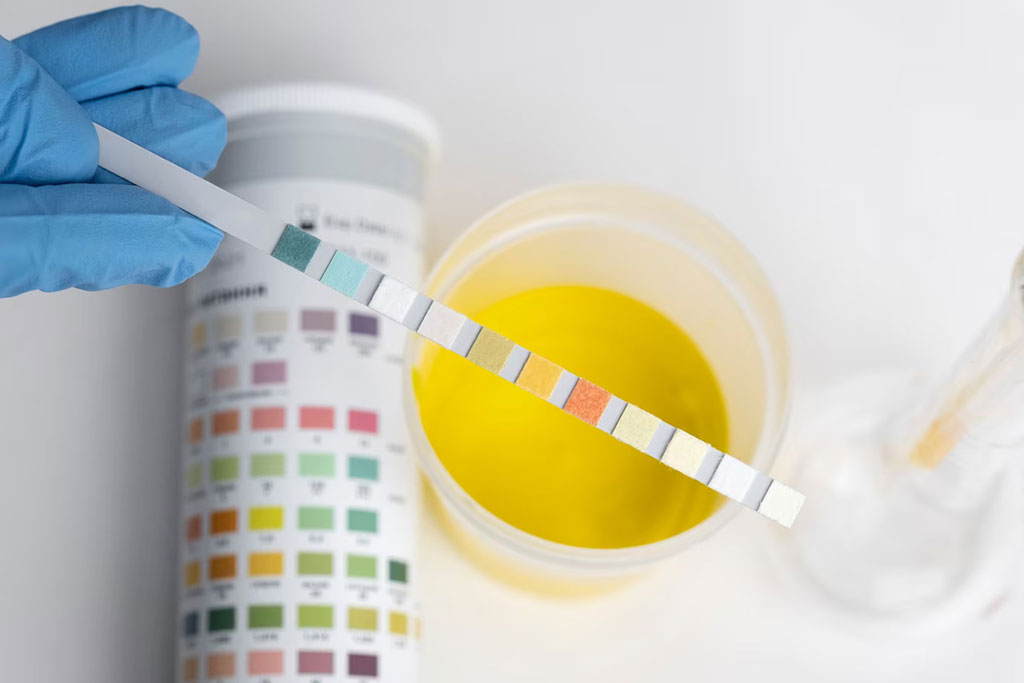 Image: The global urinalysis test market is expected to surpass USD 6 billion by 2031 (Photo courtesy of Freepik)