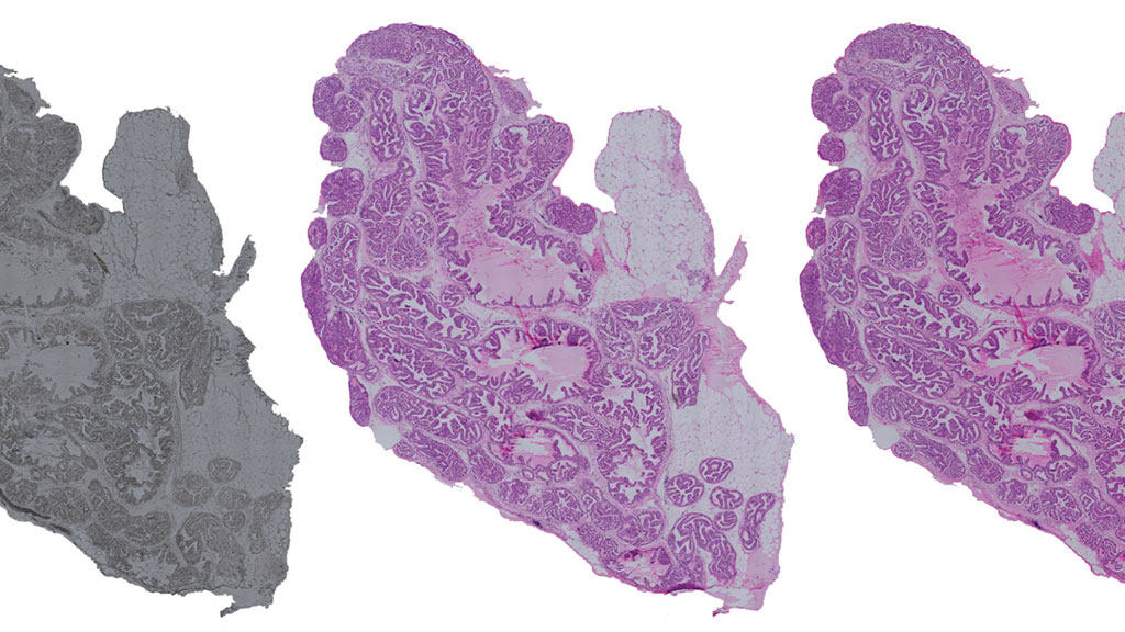 Image: An example of virtual staining of tissue (Photo courtesy of University of Turku)