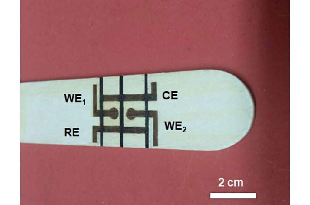 Image: Electrochemical cells etched by laser on wooden tongue depressor measure glucose and nitrite in saliva (Photo courtesy of Analytical Chemistry)