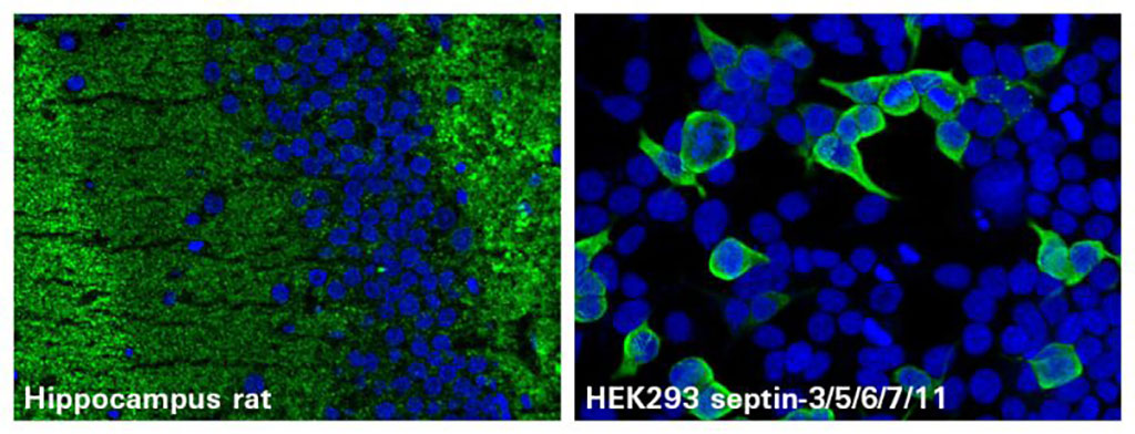 Image: septin-3 is a novel autoantibody target in patients with paraneoplastic cerebellar syndromes (Photo courtesy of EUROIMMUN)