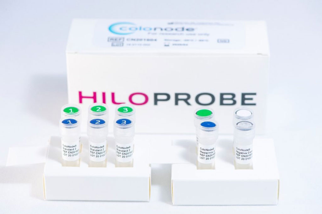 Image: ColoNode is a new type of biomarker test for colorectal cancer (Photo courtesy of Hiloprobe)