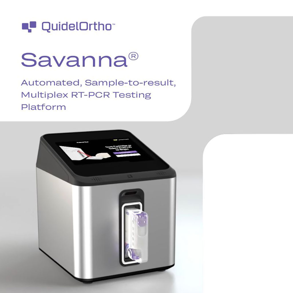 Image: The Savanna automated sample-to-result multiplex RT-PCR testing platform (Photo courtesy of QuidelOrtho)