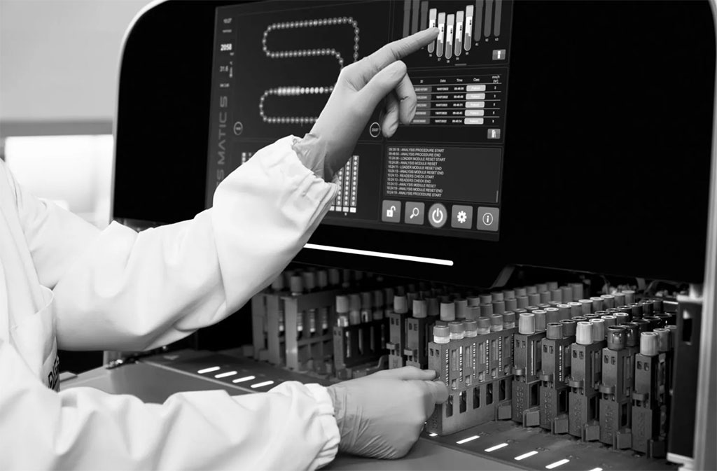 Image: The CHORUS EVO immunochemistry analyzer features innovative digital technologies (Photo courtesy of Diesse Diagnostica)