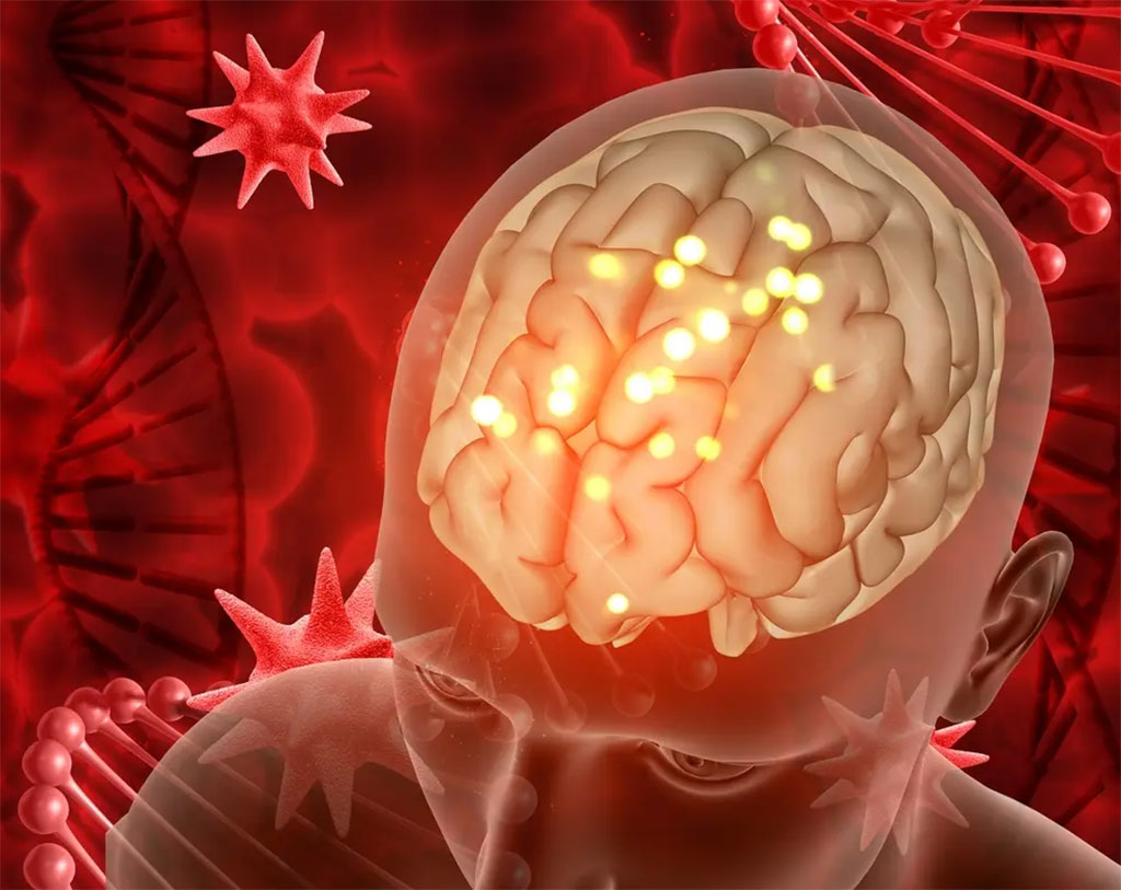 Image: Blood tests can show brain impact of neurosurgery (Photo courtesy of Freepix)