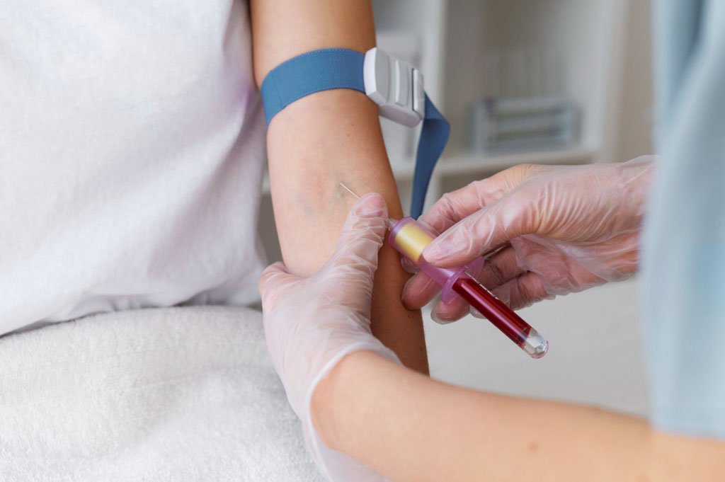 Image: A new diagnostic blood test can detect a rare but treatable condition called De Vivo disease (Photo courtesy of Freepik)