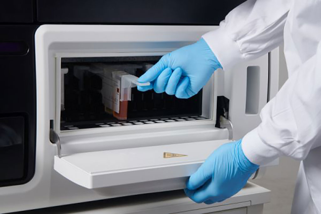 Image: The LIAISON B•R•A•H•M•S MR-proADM immunodiagnostic assay runs on the Liaison CLIA analyzer family (Photo courtesy of DiaSorin)