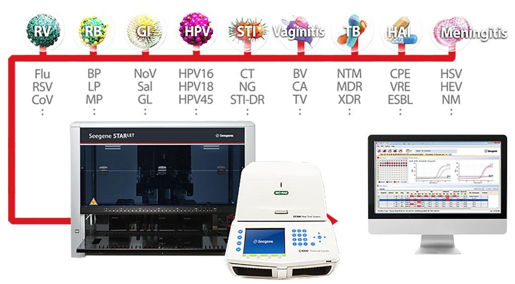 Image: The Seegene All-in-One Platform is a unique streamlined automation system (Photo courtesy of Seegene)