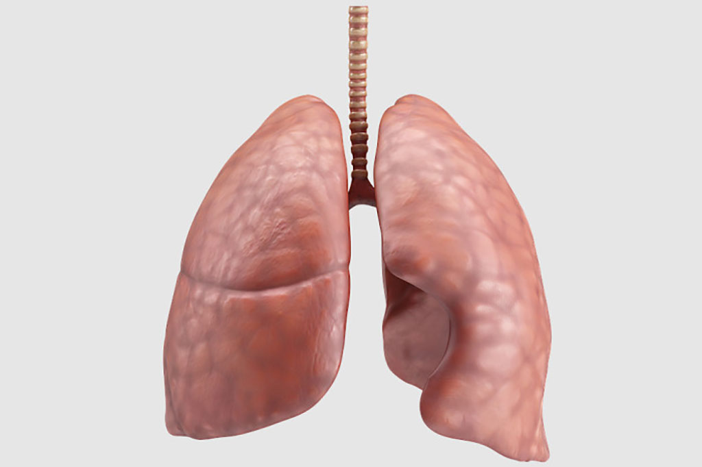 Image: Researchers have identified new biomarkers of the most frequent lung cancer (Photo courtesy of Freepik)