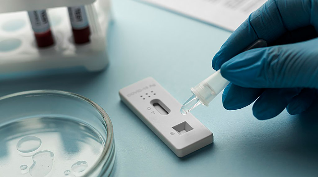 Image: The global lateral flow assays market is expected to touch USD 14 billion in 2030 (Photo courtesy of Freepik)