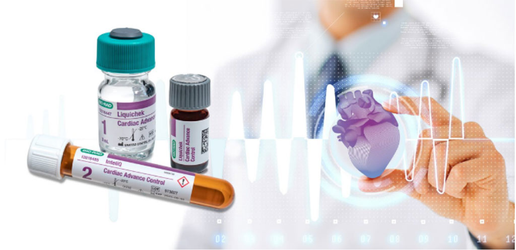 Image: The Cardiac Advance Control contains the ten most tested cardiac analytes (Photo courtesy of Bio-Rad)