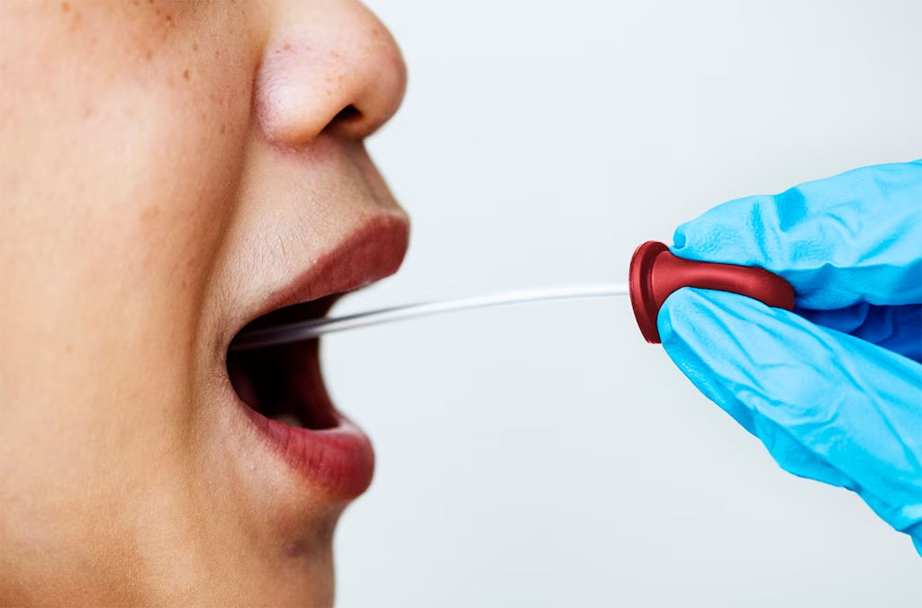 Image: Researchers are aiming for a rapid biomarker diagnostic test for stroke using saliva (Photo courtesy of Freepik)