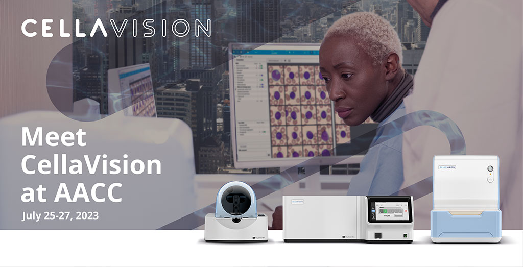Image: The new DIFF-Line complete workflow solution for low-volume hematology laboratories is on display at AACC 2023 (Photo courtesy of CellaVision)
