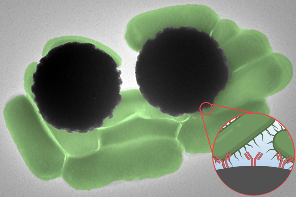 Image: Dynabeads (grey spheres) interacting with Salmonella bacterium (in green) (Photo courtesy of MIT)