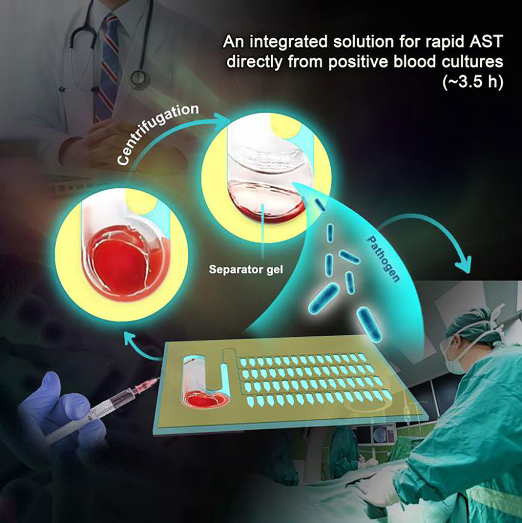 Image: On-chip pretreatment and rapid AST based directly on positive blood cultures (Photo courtesy of Liu Yang)
