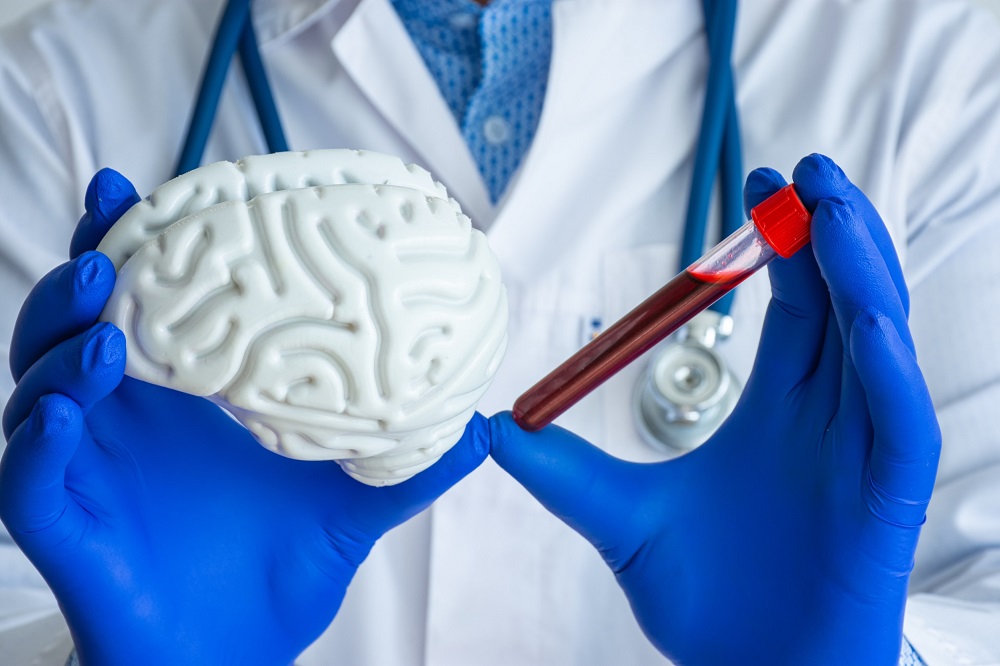 Image: A new blood test could improve concussion diagnosis (Photo courtesy of 123RF)