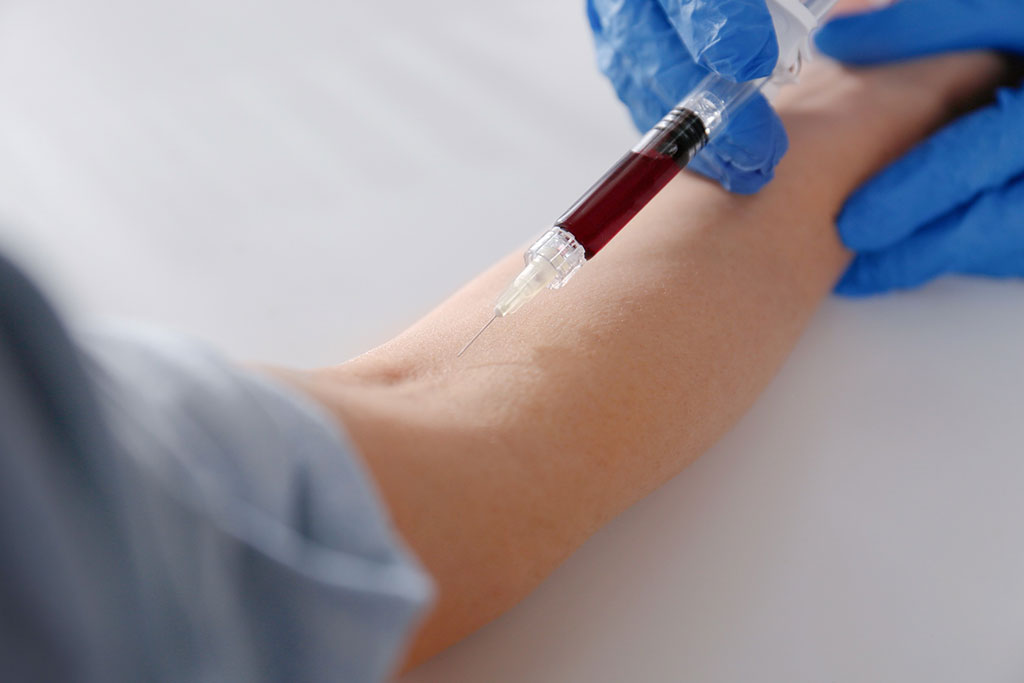 Image: The Karius Test is a liquid biopsy for infectious diseases (Photo courtesy of 123RF)