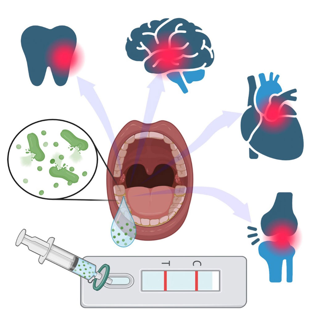 Image: The new test can warn consumers about periodontal disease which can lead to heart diseases (Photo courtesy of University of Cincinnati)