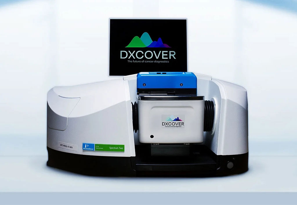 Image: The Dxcover platform detects the presence or absence of disease in minutes (Photo courtesy of Dxcover)