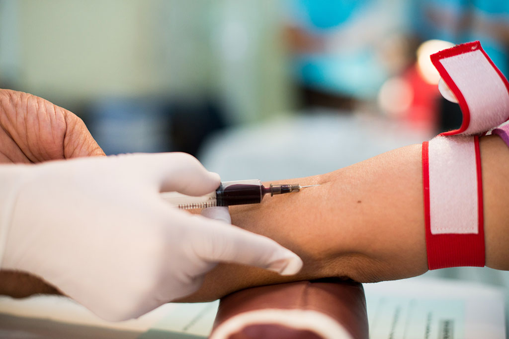 Image: A simple blood draw may improve early diagnosis and reduce invasive tests in people with LFS (Photo courtesy of 123RF)