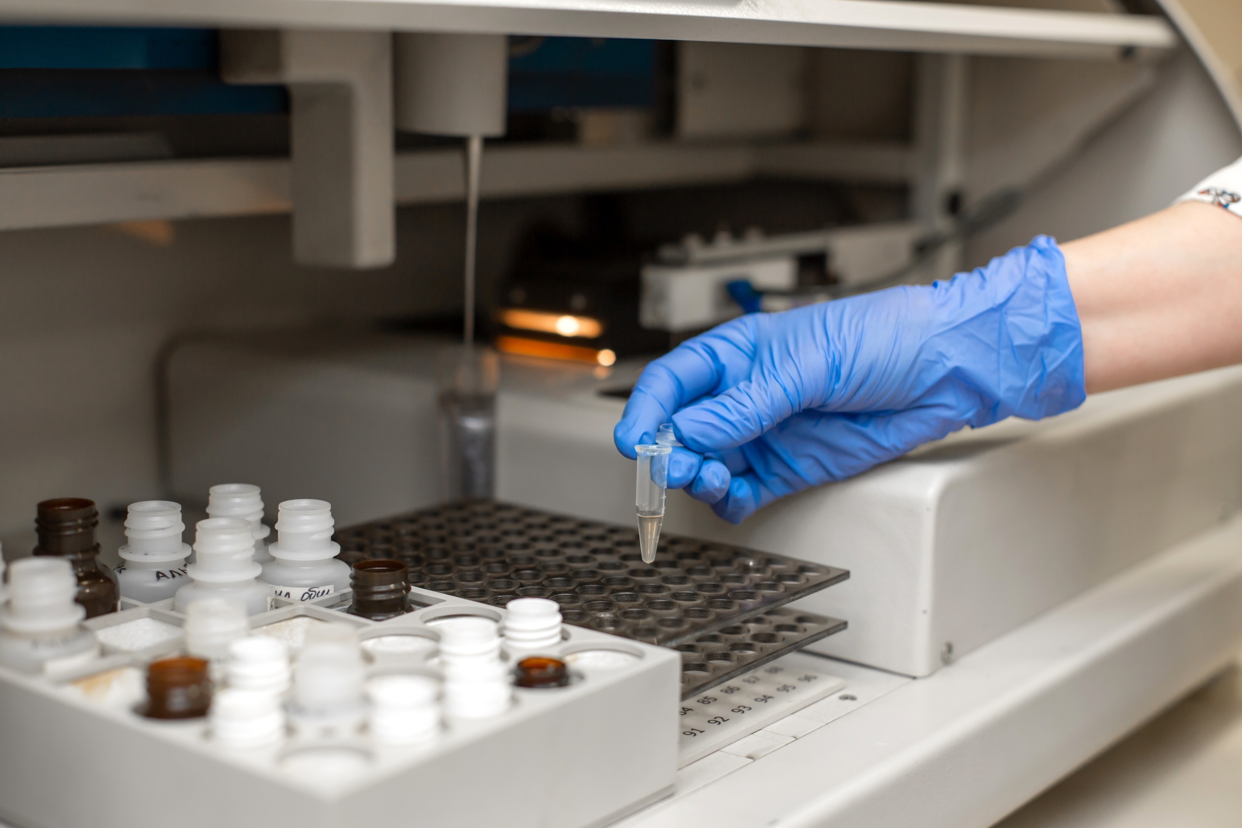 Image: The global ELISA analyzers market is expected to register an impressive CAGR during the 2024-2028 forecast period (Photo courtesy of 123RF)