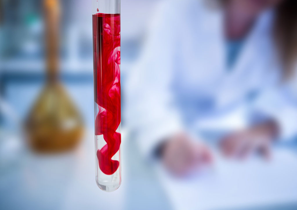 Image: The new blood test could offer earlier detection of common deadly cancers (Photo courtesy of 123RF)