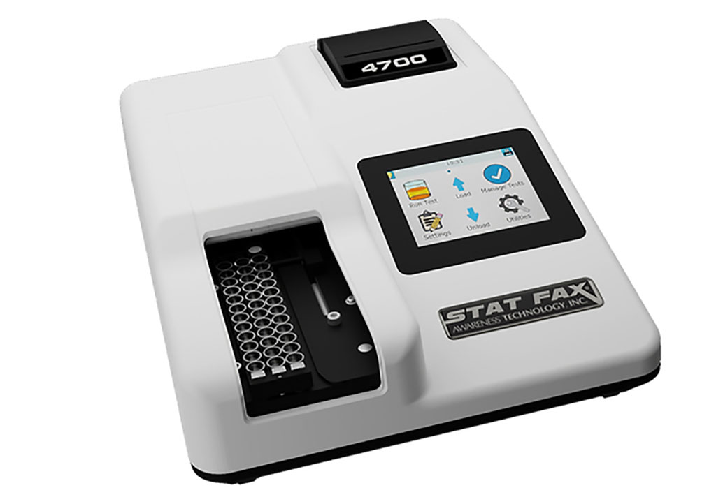 Image: The Stat Fax 4700 is a compact, economical, standalone microstrip reader (Photo courtesy of Awareness Technology)