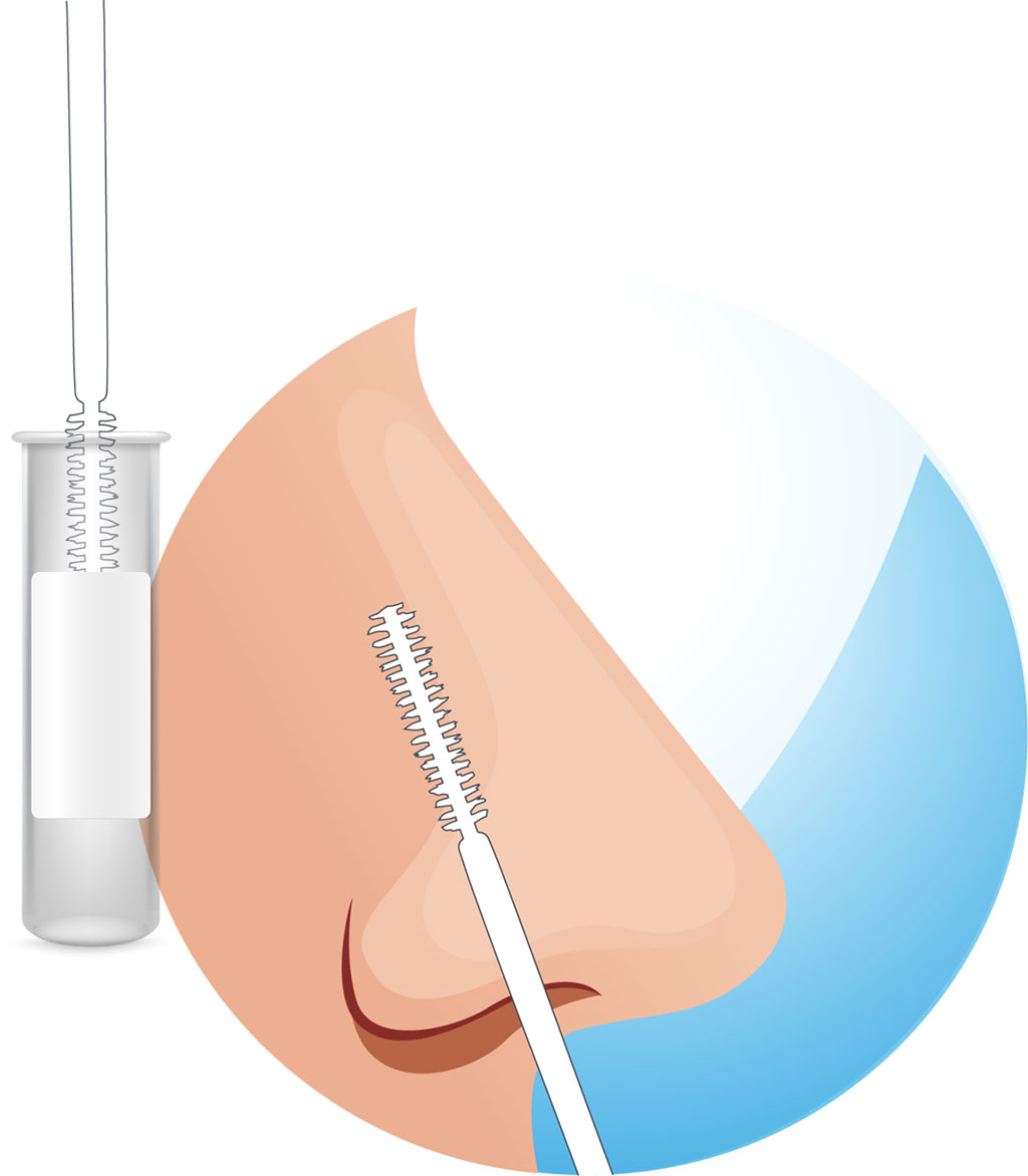 Image: Percepta Nasal Swab uses a simple and convenient nasal brushing to objectively evaluate suspicious lung nodules (Photo courtesy of Veracyte)