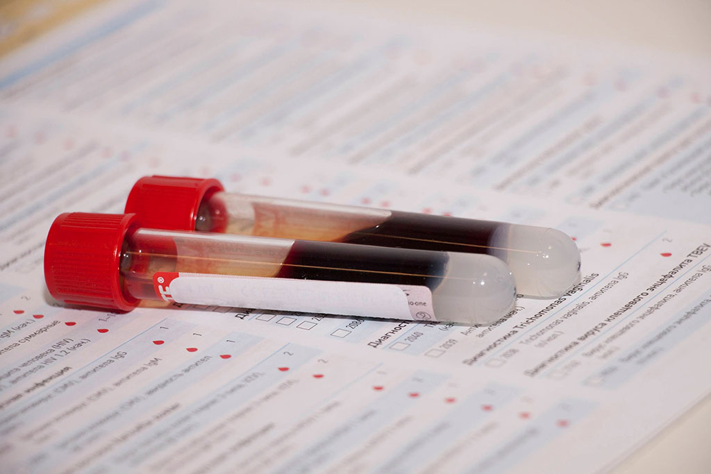 Image: A new blood-based test identifies the pathology that triggers Parkinson’s disease before symptoms occur (Photo courtesy of 123RF)