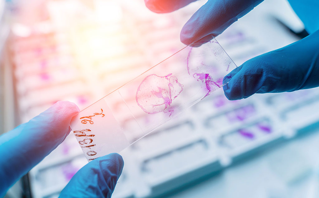 Image: The epiCervix test utilizes DNA methylation analysis which may improve risk stratification in cervical screening (Photo courtesy of 123RF)