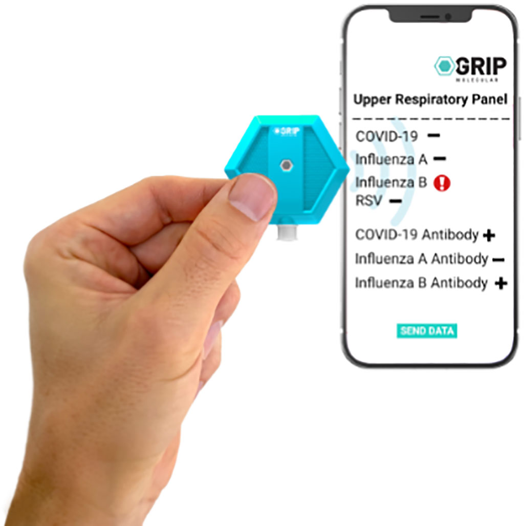 Image: The GRIP biosensor sits at the interface of molecular biology and solid state electronics (Photo courtesy of GRIP)