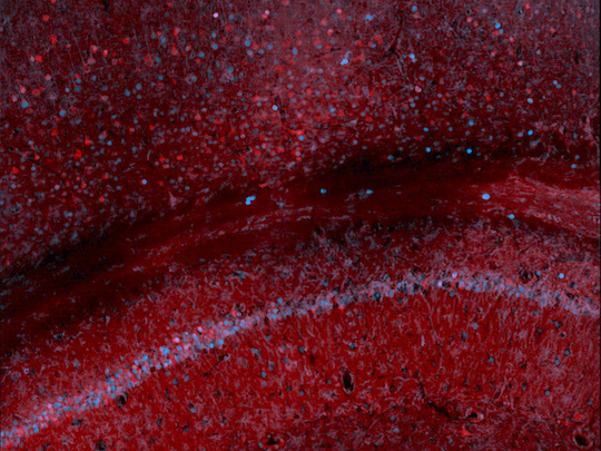 Image: Scan of the mouse hippocampus and cortex (Photo courtesy of Rice University)
