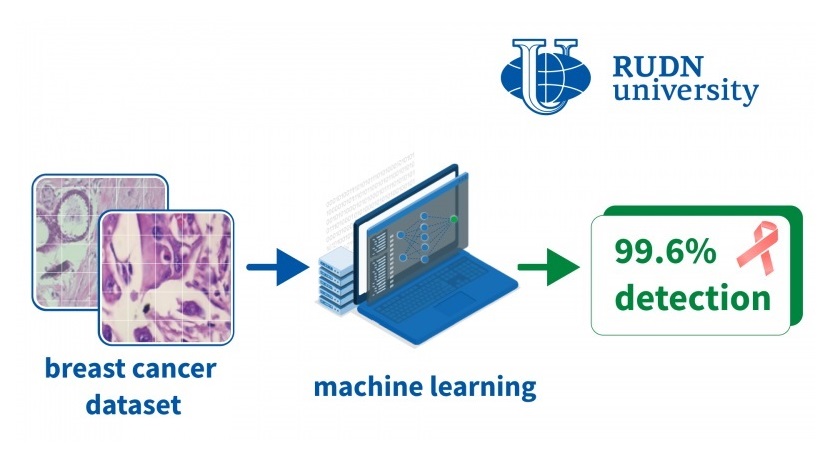Image: The “attentive” neural network recognizes breast cancer with 99.6% accuracy (Photo courtesy of RUDN University)