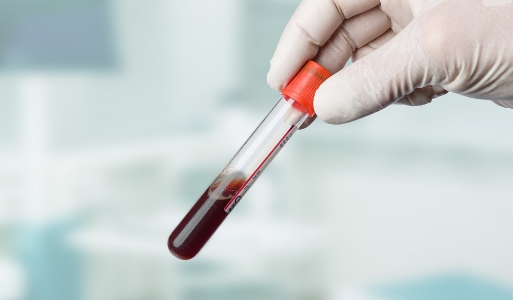 Image: A new blood test predicts psychosis risk and the most effective treatments (Photo courtesy of 123RF)