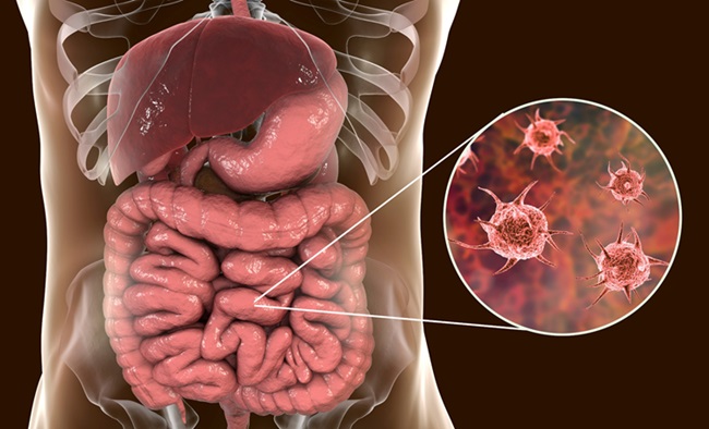 Image: Mucus contains vital data to help address inflammatory bowel disease and colon cancer (Photo courtesy of 123RF)