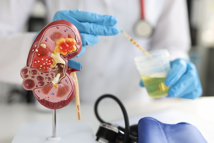 Image: Cells harvested from urine offers potential for non-invasive diagnostic testing of kidney disease (Photo courtesy of 123RF)