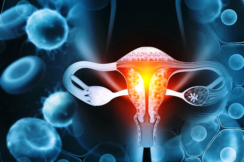 Image: A kinder test could improve diagnosis of womb cancer (Photo courtesy of crytal light/Shutterstock)