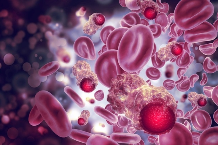 Image: A new technique has demonstrated the ability to identify single cancer cells in blood for the first time (Photo courtesy of crystal light/Shutterstock)