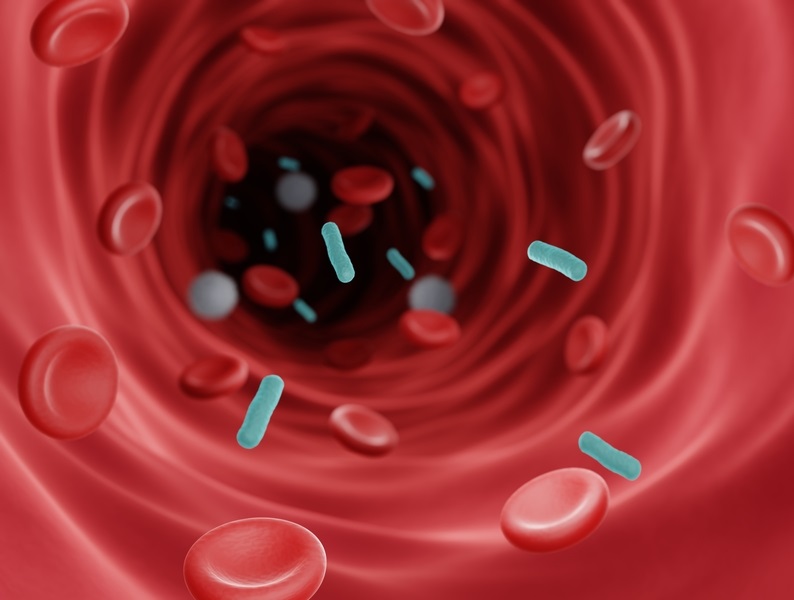 Image: The real-time multiplex PCR test is set to revolutionize early sepsis detection (Photo courtesy of Shutterstock)