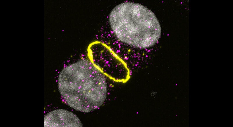 Image: Cells dying by necroptosis, an inflammatory form of cell death (Photo courtesy of WEHI)