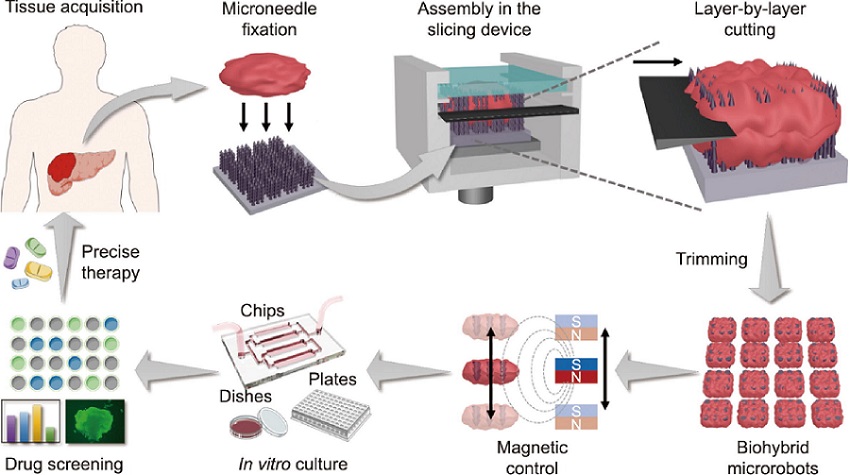 Image: Schematic illustration of tumor tissue slicing, manipulation, and cultivation for high-throughput drug screening (Photo courtesy of Xiaoxuan Zhang et al.)