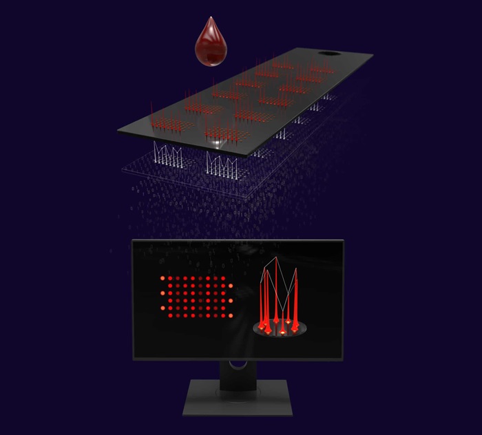 Image: The simple blood-based test can detect proteins and antibodies that indicate a high-risk individual has developed pancreatic cancer (Photo courtesy of Immunovia)