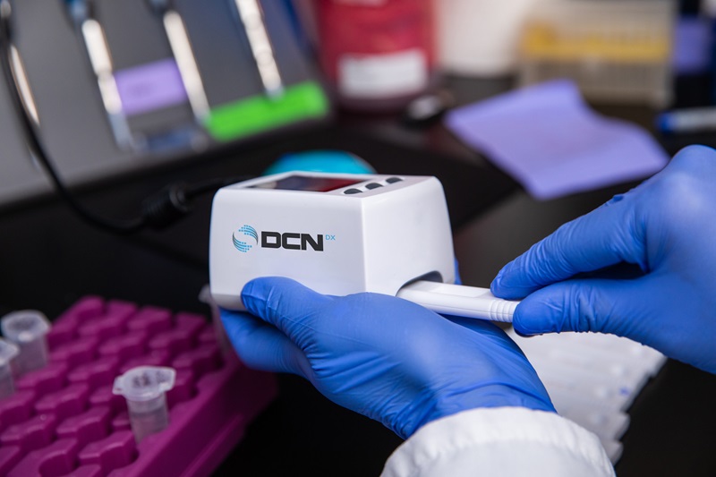 Image: The miniDxR sets a new standard for customizable lateral flow test readers in clinical and laboratory applications (Photo courtesy of DCN Dx)