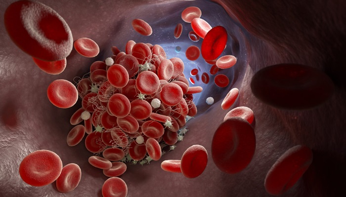 Image: The new platelet-centric scoring system predicts platelet hyperreactivity and related risk of cardiovascular events (Photo courtesy of Shutterstock)