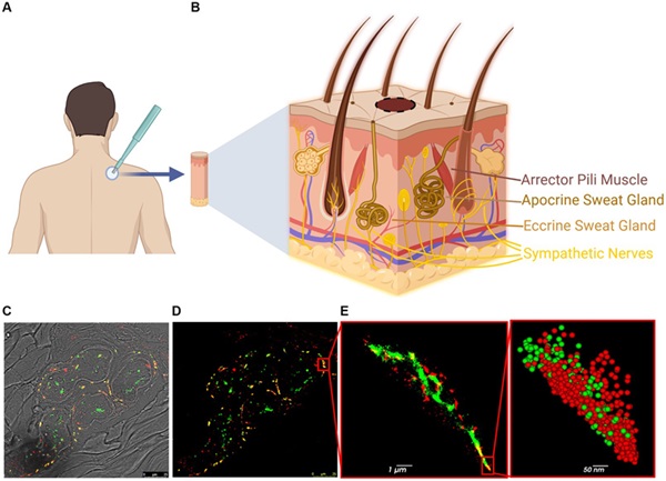 Image: Steps and methodology of skin biopsy processing for dSTORM (Photo courtesy of Front. Mol. Neurosci. (2024); DOI: 10.3389/fnmol.2024.1431549)