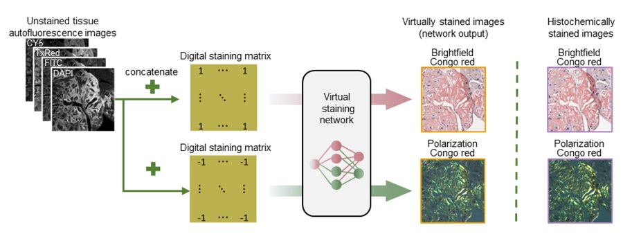 Image: Virtual birefringence imaging and histological staining of amyloid deposits in label-free tissue (Photo courtesy of Ozcan Research Group)