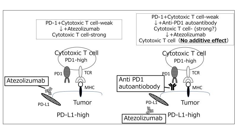 Image: Anti-programmed cell death 1 (anti-PD-1) autoantibody as a biomarker for prognosis of cancer (Photo courtesy of Dr. Akinobu Takaki/Okayama University)