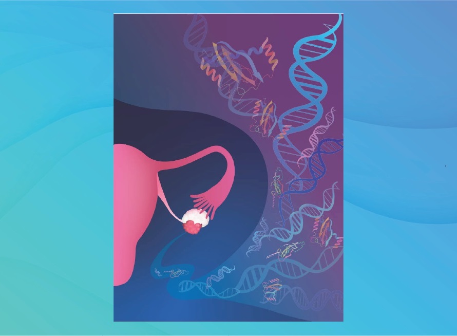 Image: Using the “liquid biopsy” tests could spare women with benign growths having to undergo unnecessary surgery (Photo courtesy of Carolyn Hruban, Ph.D.)